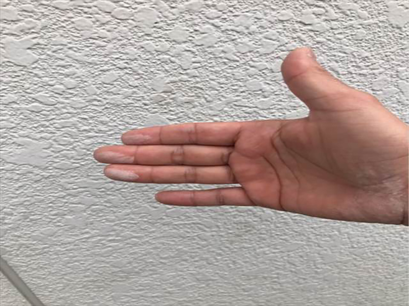 外壁を触ると白い粉がつく「チョーキング現象」と呼ばれる状態がみられました。  経年劣化によって現れる現象で、外壁塗装をする目安になります。